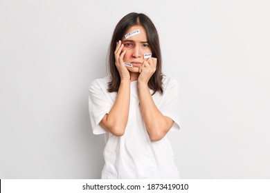 Panicked Frustrated Woman Becomes Victim Of Savage Attack Has Bruize Under Eye Severe Head Trauma Becomes Victim Of Abuse Faces Pressure And Violence Isolated Over White Background. Beaten Female