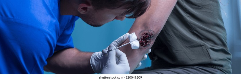 Panorama Of Surgeon Medicating Bloody Elbow Open Wound