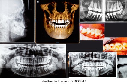 Panoramic And 3D Dental X-ray Many Shots