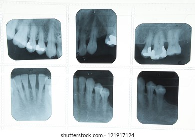 Panoramic dental X-Ray for dentist