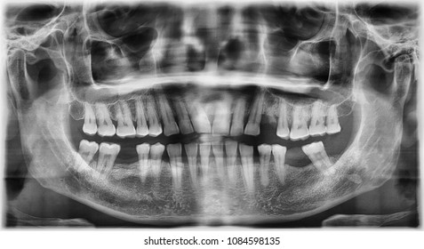 Panoramic Xray High Res Stock Images Shutterstock