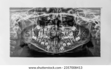 Panoramic shot of children's teeth. Selective focus. child.