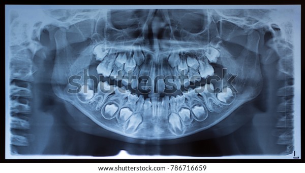 5,253 Dentition Stock Photos, Images & Photography | Shutterstock