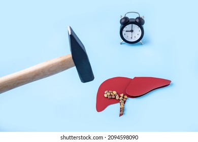  paper model of a human liver with a gallbladder made of stones, a hammer and a clock on a blue background. the concept of timely treatment of liver diseases