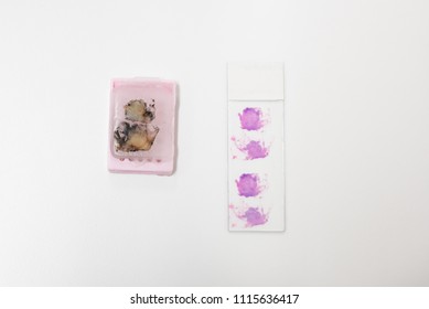 Paraffin Box Human Tissue And Slide Hemotoxylin And Eosin Stain (H And E) On White Table Background.Pathology Medical Concept.