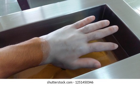 Paraffin Wax, Physical Therapy, Physical Finger