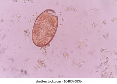 Paragonimus (Lung flukes) and entamoeba coli in stool. Stock Photo