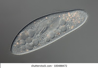 Paramecium caudatum differential interference contrast DIC focus to mouth field, cilia, food vacuoles, crystals