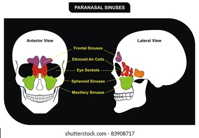 Sphenoid Sinus Images Stock Photos Vectors Shutterstock