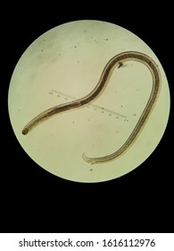 Parasite In The Fish, Hookworm