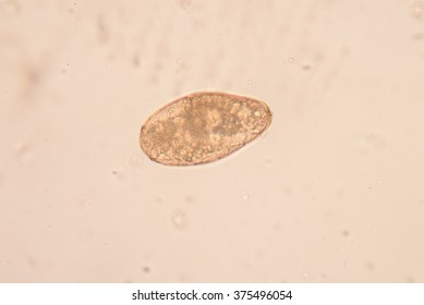 Parasite Stool Exam Fine Microscope Laboratory Stock Photo 375496054 ...