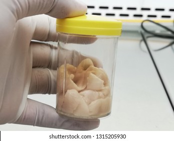 Parasite taenia spp.Taenia saginata (beef tapeworm).Fresh Parasite That came out of the vomiting of people.Tapeworm.
