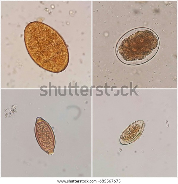 Enterobius vermicularis ova in stool. 36 Best Paraziti images | Asistente, Laborator, Medicină