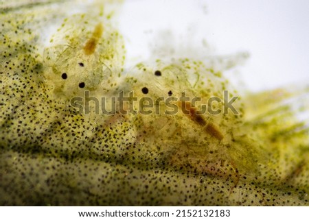 Parasitic (Argulus sp.), Study of Argulus sp. under microscope view in laboratory.
