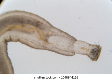 Parasitic (Thorny-head worm) under the microscope of education in laboratory.