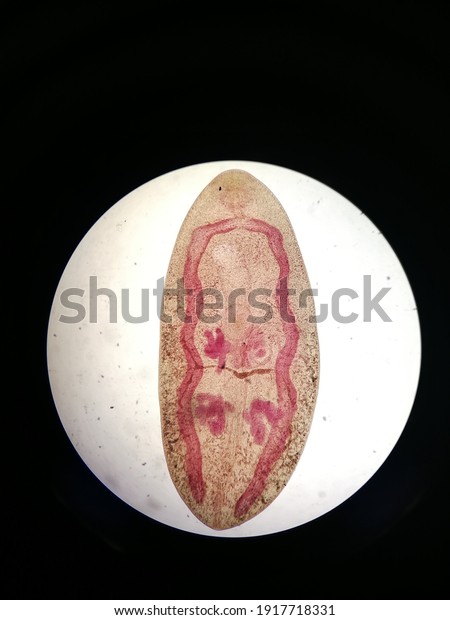 paragonimus westermani egg size