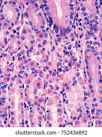 Parietal (oxyntic) Cells Are A Cell Type Located In The Stomach's Fundic Glands. They Have An Eosinophilic (pink) Cytoplasm. In The Upper Area Of The Image Appears The Bottom Of A Gastric Pit.