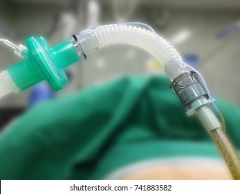 Part of the endotracheal tube to help the the breathing system of patients undergoing surgery.