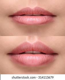 Part of face, young woman close up. Sexy plump lips after filler injection