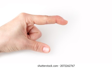 Part Of Left Hand Showing Downwards Direction, Index Finger With A Extensor Tendon Injury Pointing Way, Mallet Finger Tip Bending Down, Deformity In The Last Phalangeal Bone, Poster