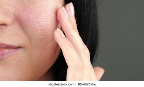 Part Of A Woman's Face Close-up. Woman Touches Problem Skin.