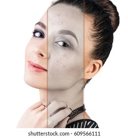 Part of woman's face showing problems skin.