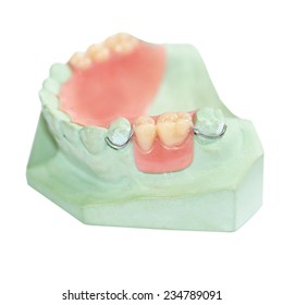 Partial  denture production  on white background