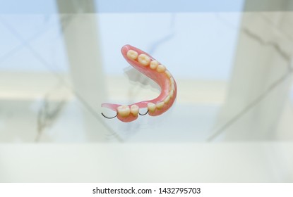 partial laminar denture to restore the integrity of the dentition 