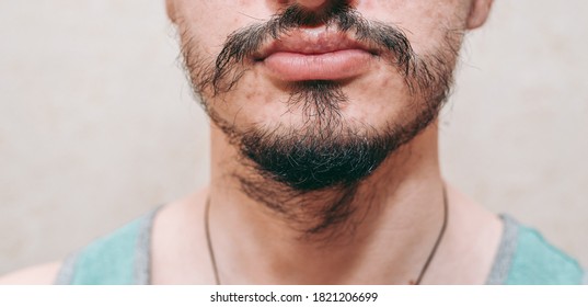 45 Patchy Beard Images, Stock Photos & Vectors | Shutterstock