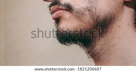 Patchy beard on a man's face