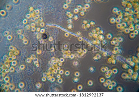 Pathogens magnified by a microscope