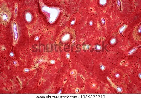 Pathology of human compact bone tissue under light microscope view, muscle bone connection and connective tissue. Haematoxylin and eosin staining technique.