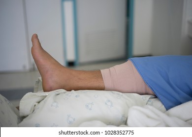 Patient After Surgery Knee Sleep On The Bed Health And Medical Concept