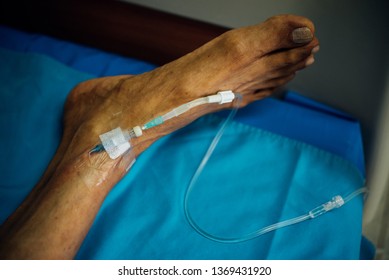 Patient asian elder man 80s with saline intravenous at C-line or A-line on a elderly patient foot instep on patient bed in intensive care unit (ICU.) room at hospital.