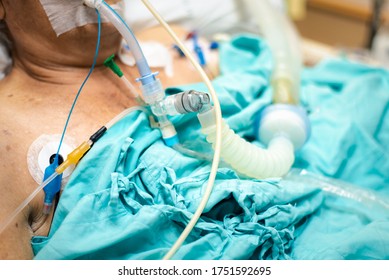 Patient Asian Elder Women 80s Flu Covid19 Do Tracheostomy Use Ventilator For Respiration Breathing Help On Patient Bed In Intensive Care Unit (ICU.) Room At Hospital In Concept Healthcare In Life