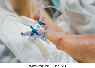 Patient Asian Elder Women 80s Flu Covid19 Do Tracheostomy Use Ventilator For Respiration Breathing Help On Patient Bed In Intensive Care Unit (ICU.) Room At Hospital In Concept Healthcare In Life