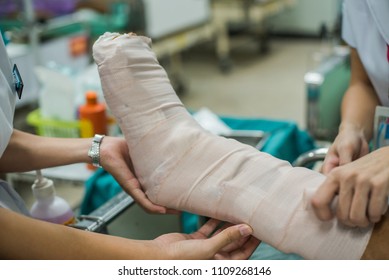 Patient With Broken Leg And Splinted For Treatment In The Hospital.