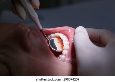 Patient at dentists office, getting her white teeth interdental spaces examined with hand-held mirror for tartar and plaque. Dental hygiene, painful procedures and prevention concept.  