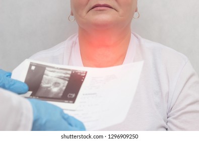 Patient At A Doctor With A Thyroid Disease Of The Nodular Goiter, Close-up, Medical, Inflammation