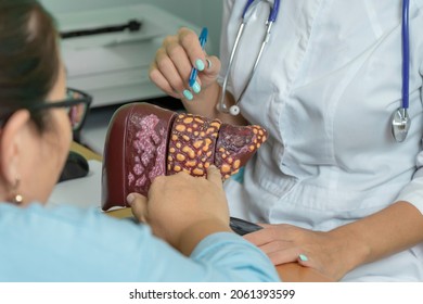 the patient at the doctor's appointment points to the model of the liver. the doctor talks about the 4 stages of development of cirrhosis.