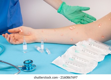 Patient at the doctor's office with symptoms of Monkeypox. Monkeypox virus concept. Monkeypox is a viral disease that occurs mainly in central and western Africa. - Shutterstock ID 2160867697
