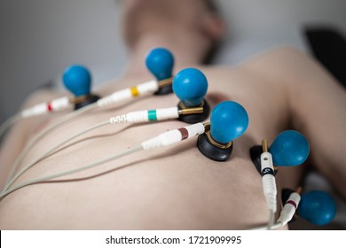 A Patient With EKG Electrodes Attached To His Body.