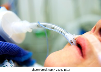 patient with a endotracheal tube in operation theater