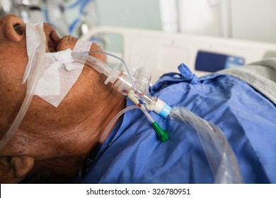 Patient with a endotracheal tube and orogastric Tube
