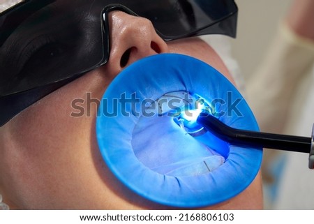 Patient getting dental treatment at dentist office with dental rubber dam protection