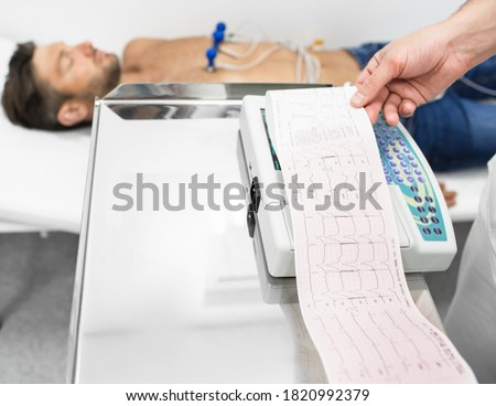 Patient getting heart rate monitored with electrocardiogram equipment. Cardiogram test, close-up of ECG report
