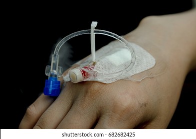 Patient hand had injection plug for injecting  fluid drug.