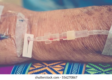 A patient in the hospital with saline intravenous, in Asian elderly man hand , process in vintage style - Shutterstock ID 556270867