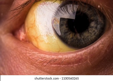Yellow Eyes High Res Stock Images Shutterstock