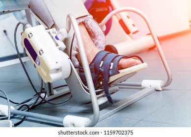 Patient On CPM (continuous Passive Range Of Motion) Machines. Device To Provide Anatomically Correct Motion To Both The Ankle And Subtalar Joints. Foot's Rehabilitation After Injured